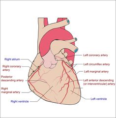 wiggers diagram aortic stenosis