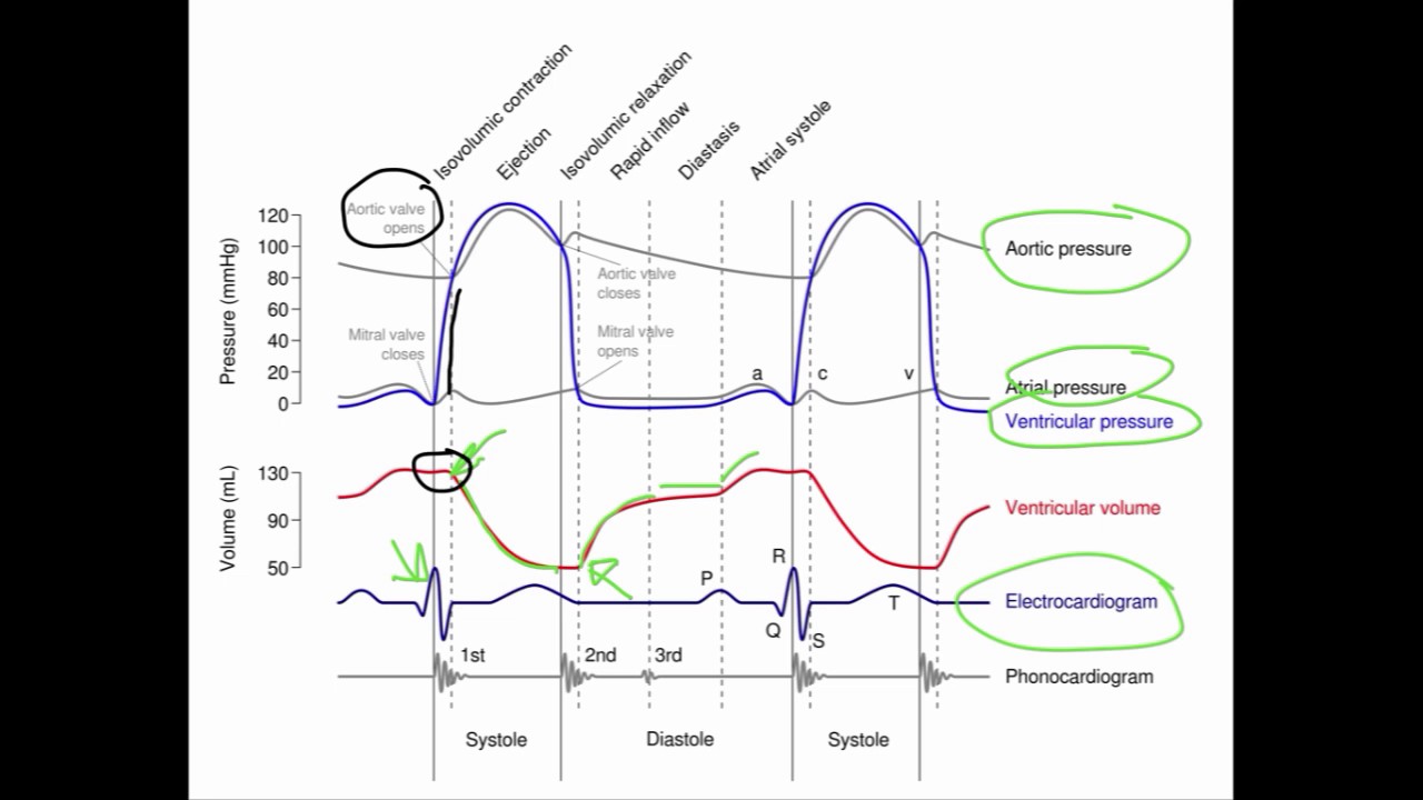 wiggers diagram made easy