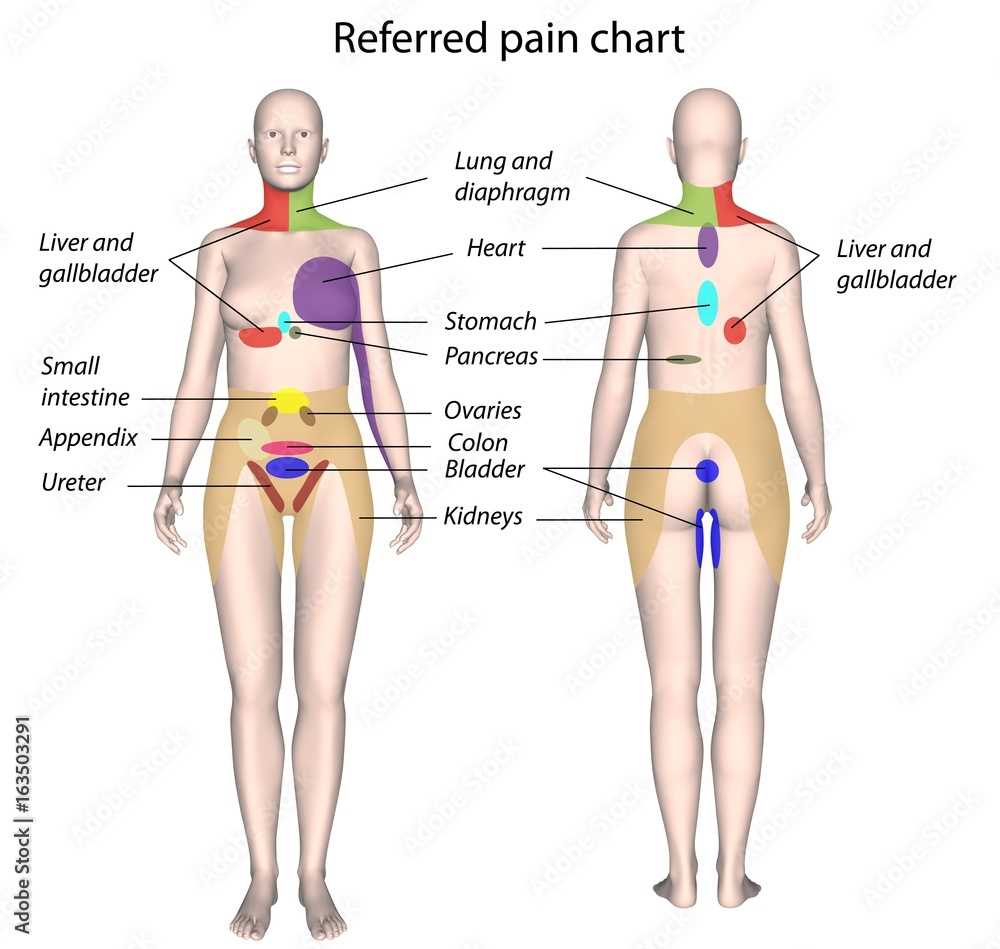 Common Pain Chart Diagram Categories