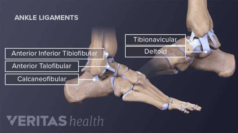 diagram of a sprained ankle